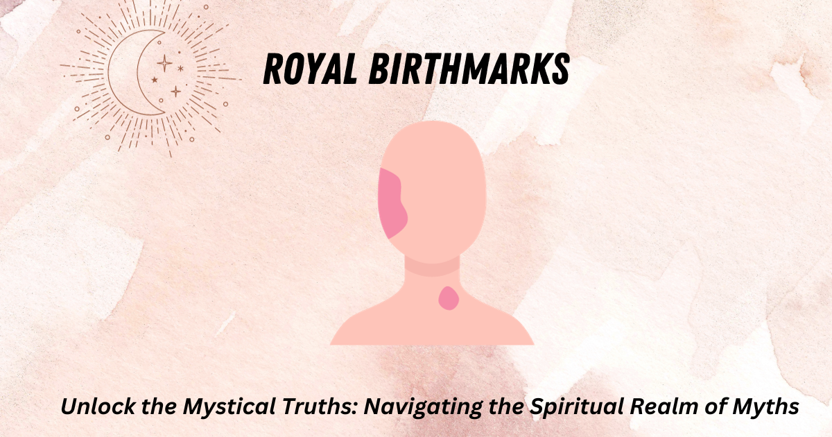 royal birthmarks